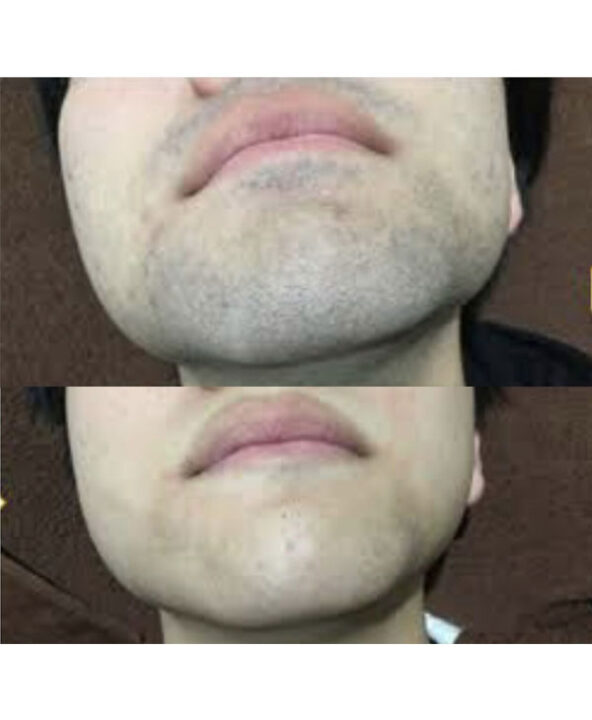 気になる青髭！ジョリジョリ！